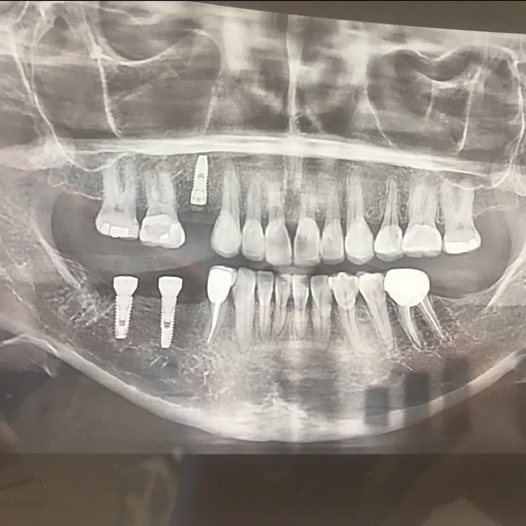 نمونه کار دکتر مهتاب سادات هاشمی پور | مطب ۳۶۵