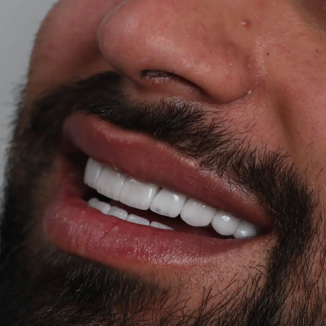 نمونه کار دکتر محمد مانیان | مطب ۳۶۵