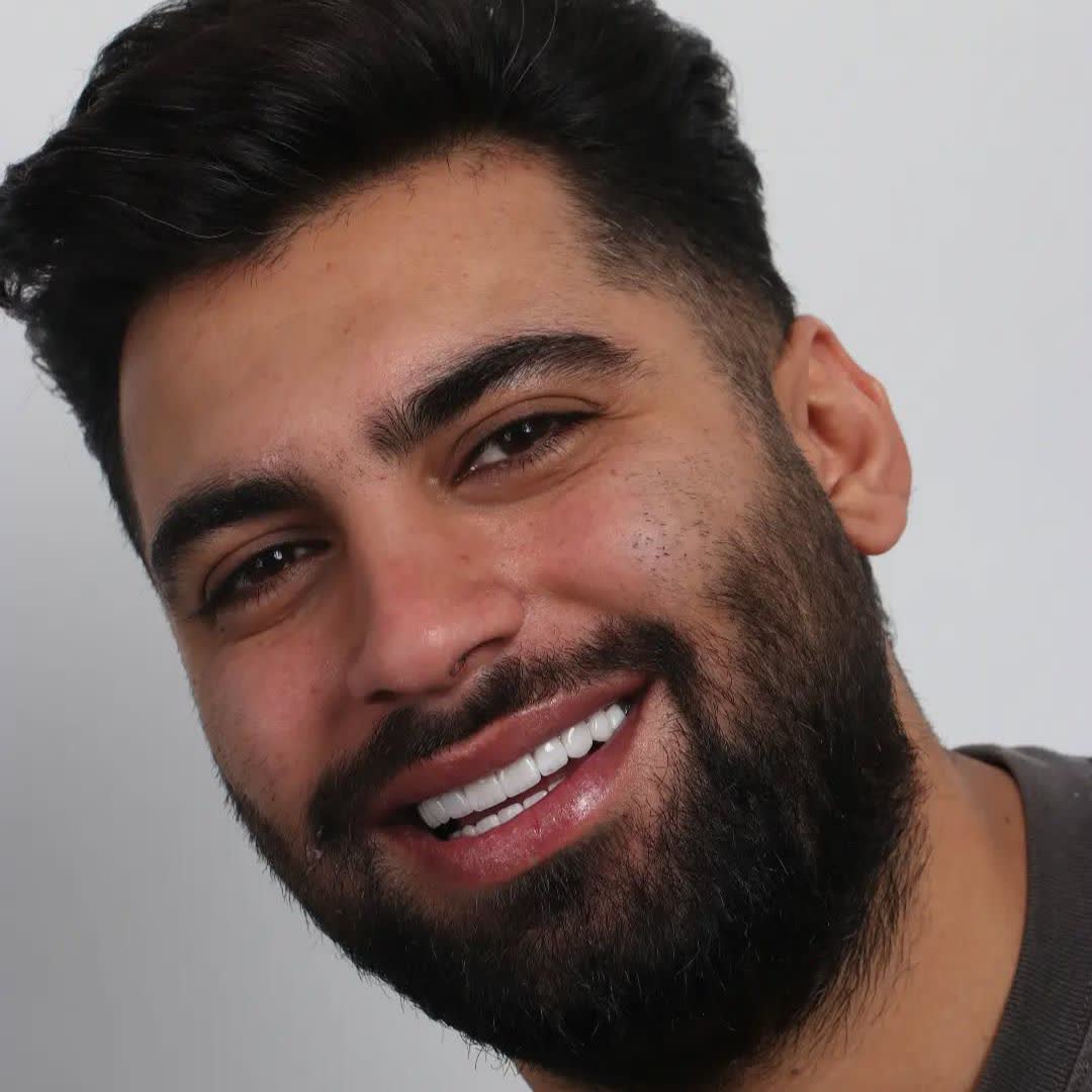 نمونه کار دکتر محمد مانیان | مطب ۳۶۵