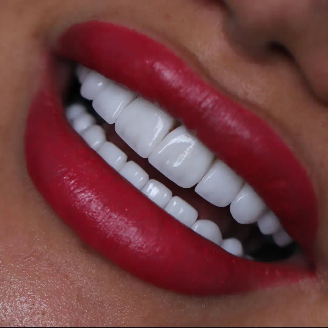 نمونه کار دکتر محمد مانیان | مطب ۳۶۵