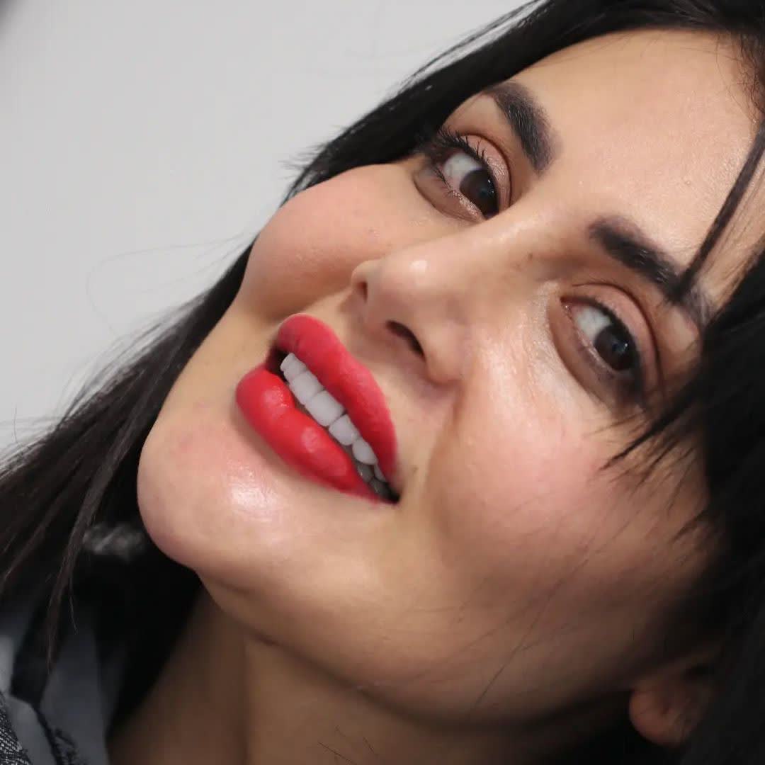 نمونه کار دکتر محمد مانیان | مطب ۳۶۵