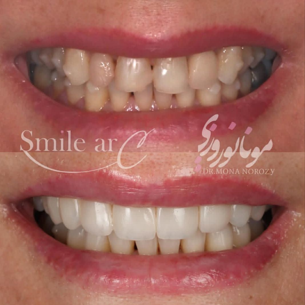 نمونه کار های دکتر مونا نوروزی | مطب ۳۶۵