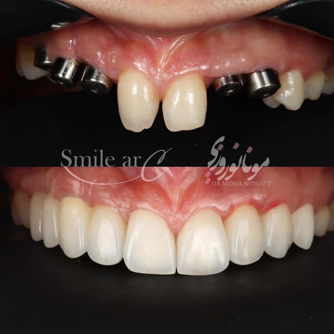 نمونه کار های دکتر مونا نوروزی | مطب ۳۶۵