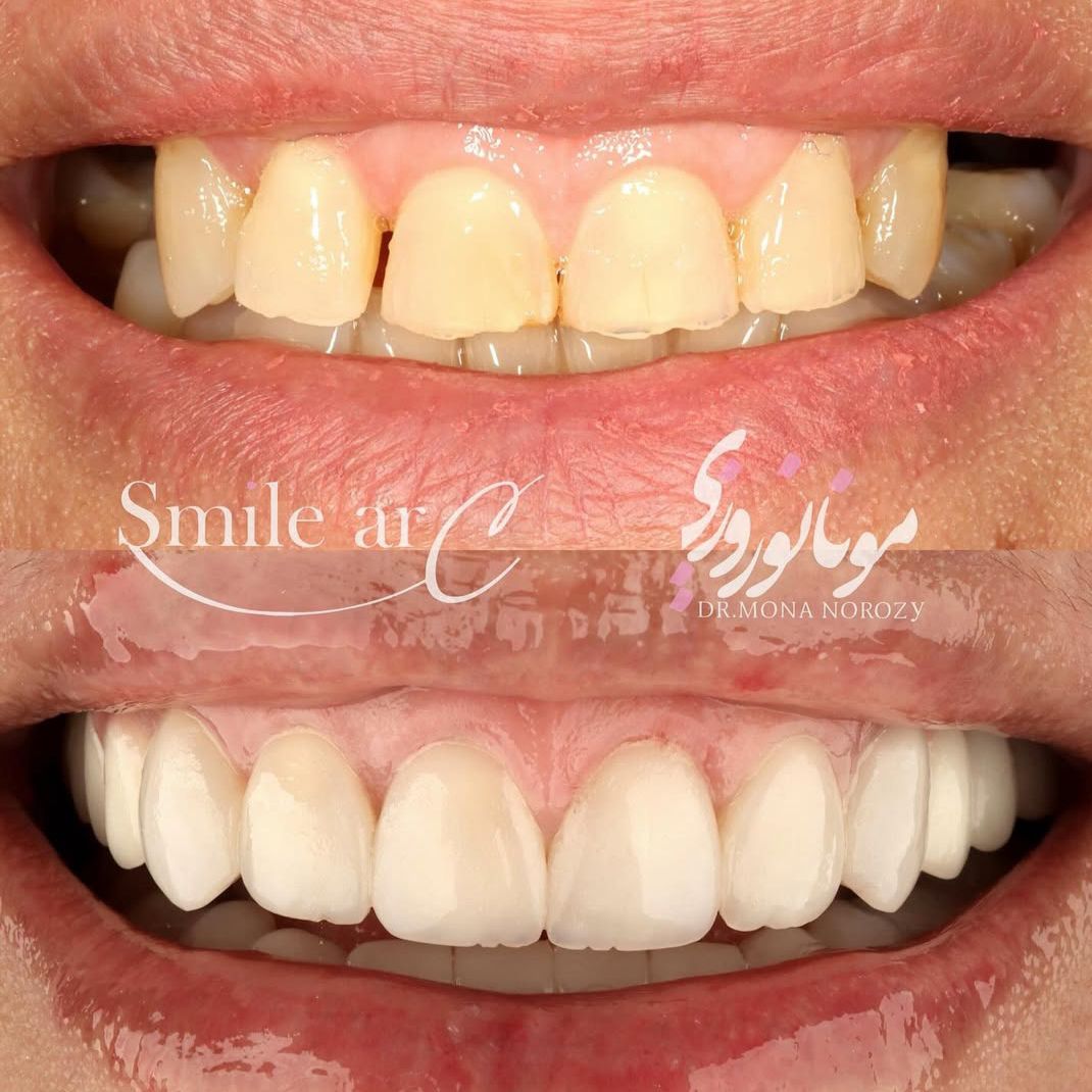 نمونه کار های دکتر مونا نوروزی | مطب ۳۶۵