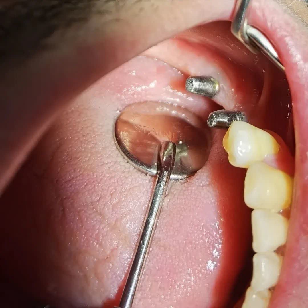 نمونه کار دکتر ناهید علیان نجف آبادی | مطب 365