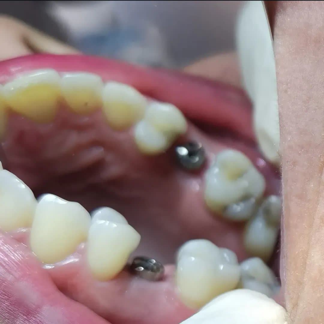 نمونه کار دکتر ناهید علیان نجف آبادی | مطب 365