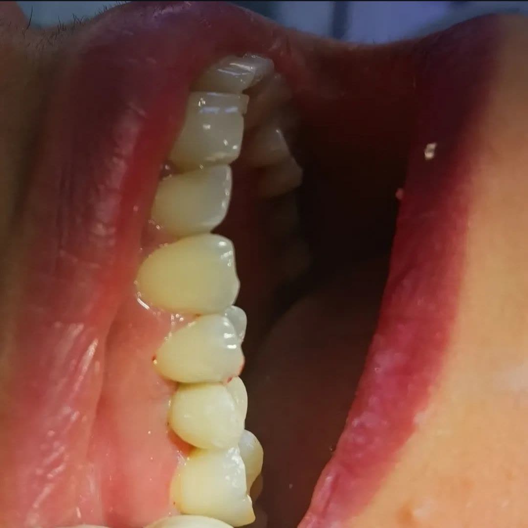 نمونه کار دکتر ناهید علیان نجف آبادی | مطب 365