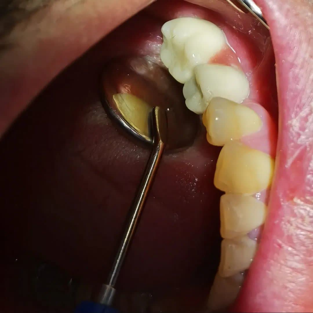 نمونه کار دکتر ناهید علیان نجف آبادی | مطب 365