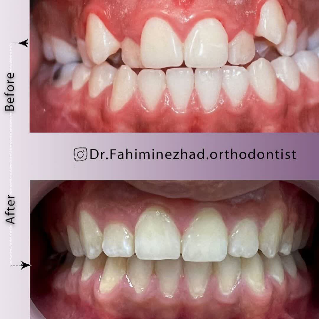 نمونه کار دکتر نسترن فهیمی نژاد | مطب 365