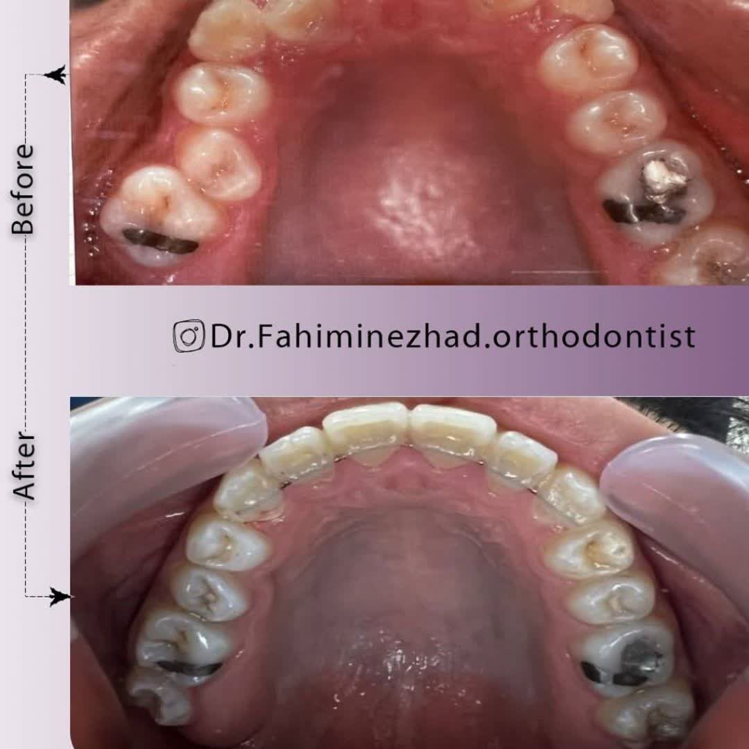 نمونه کار دکتر نسترن فهیمی نژاد | مطب 365