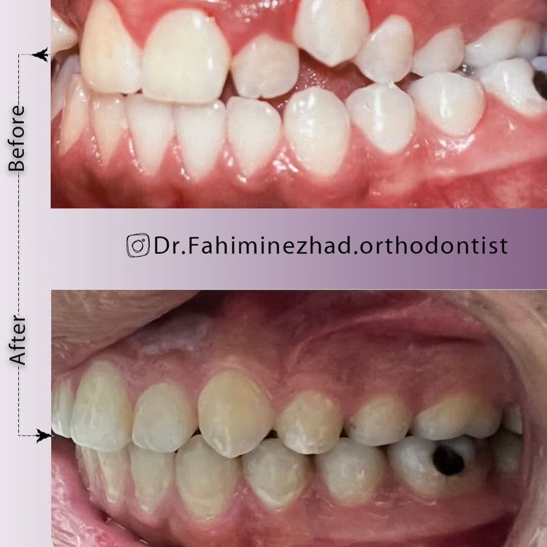 نمونه کار دکتر نسترن فهیمی نژاد | مطب 365