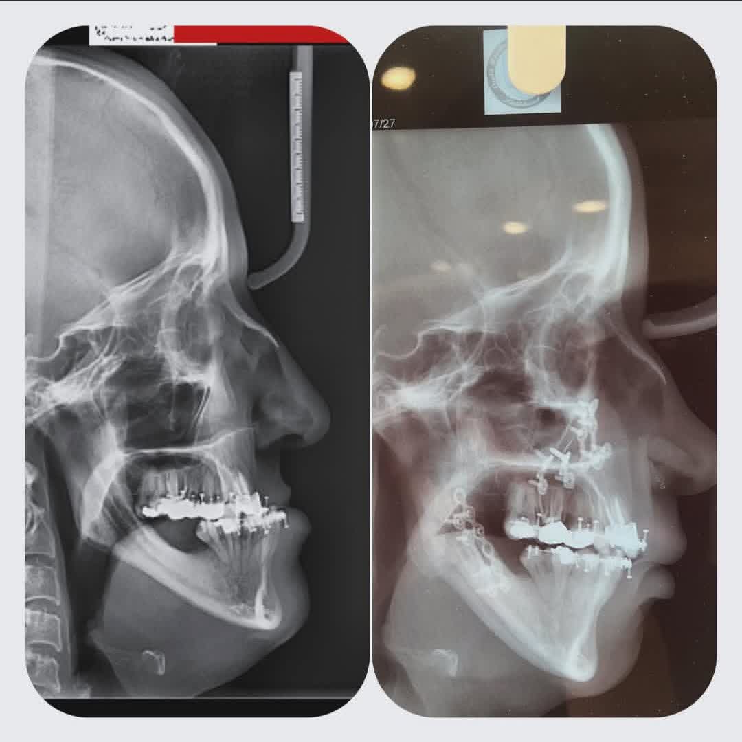 نمونه کار دکتر شکیلا پیمانی | مطب ۳۶۵