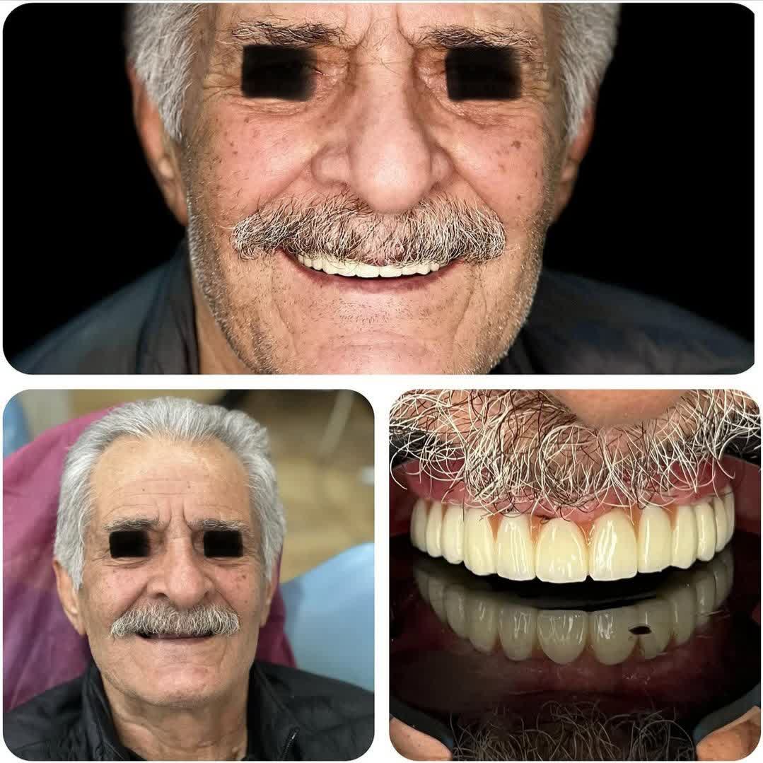 نمونه کار دکتر شکیلا پیمانی | مطب ۳۶۵