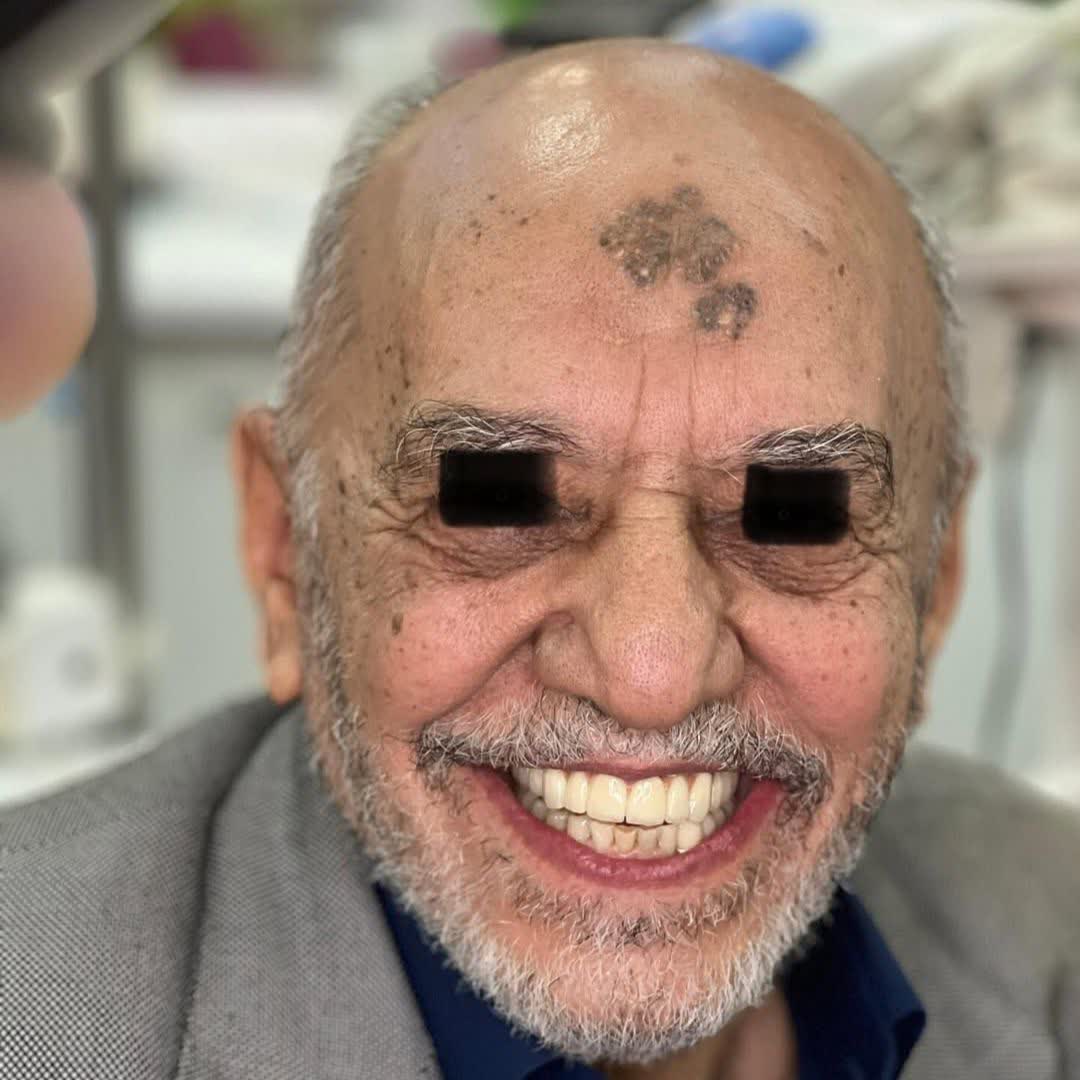 نمونه کار دکتر شکیلا پیمانی | مطب ۳۶۵