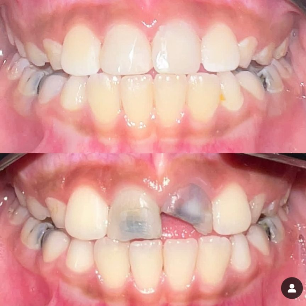 نمونه کار دکتر پدرام پیشگاهی | مطب ۳۶۵