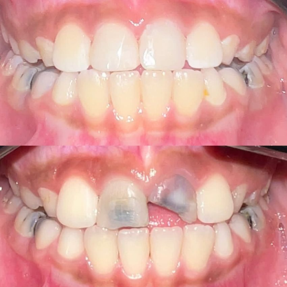 نمونه کار دکتر پدرام پیشگاهی | مطب ۳۶۵