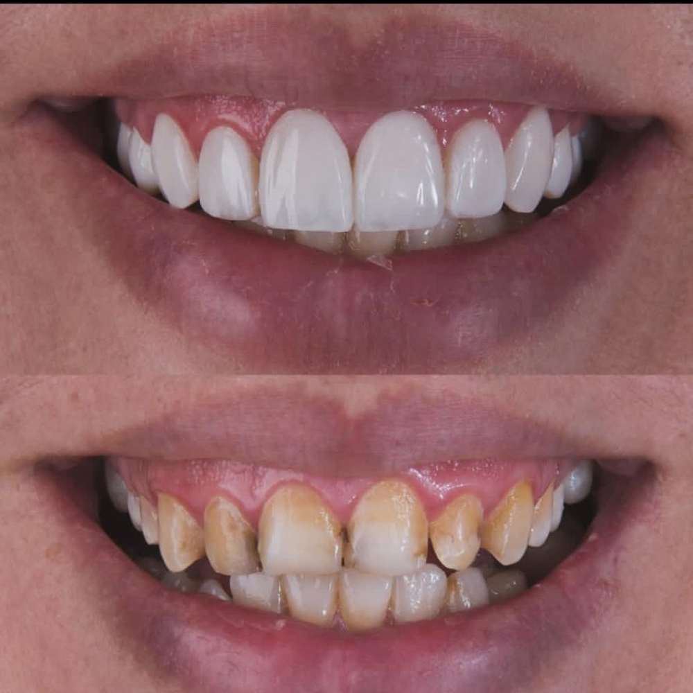 نمونه کار دکتر پدرام پیشگاهی | مطب ۳۶۵