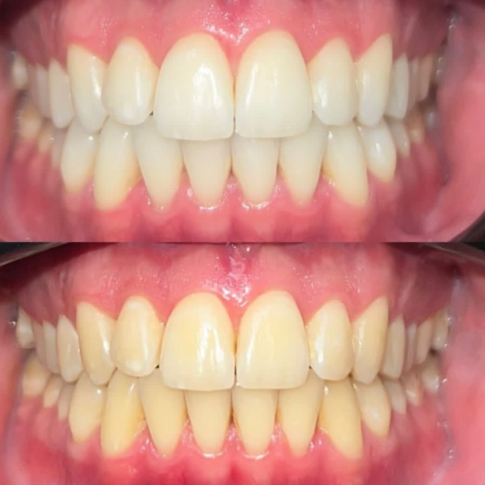 نمونه کار دکتر پدرام پیشگاهی | مطب ۳۶۵