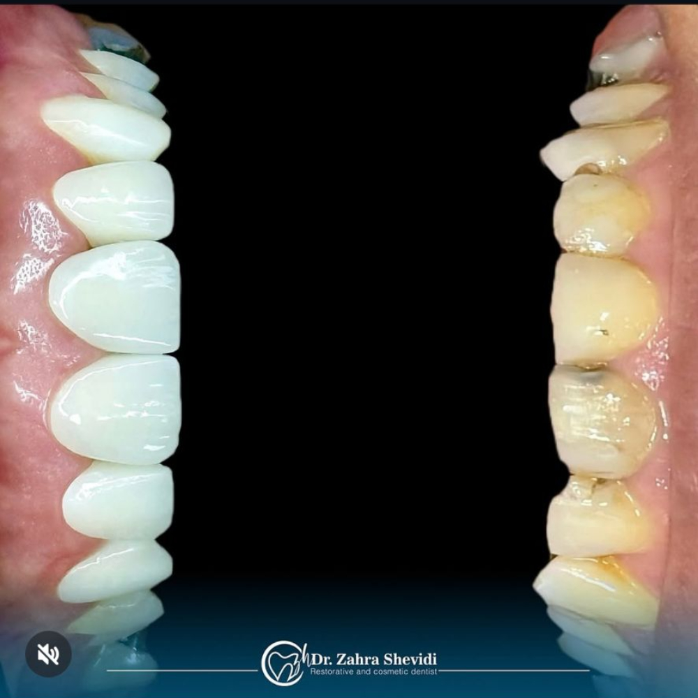 نمونه کار دکتر زهرا شویدی | مطب ۳۶۵