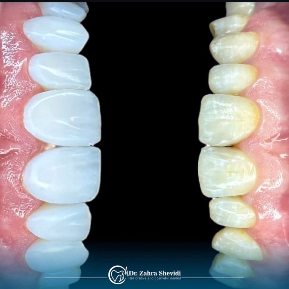 نمونه کار دکتر زهرا شویدی | مطب ۳۶۵