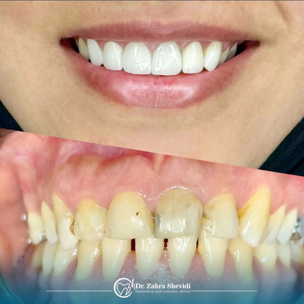 نمونه کار دکتر زهرا شویدی | مطب ۳۶۵