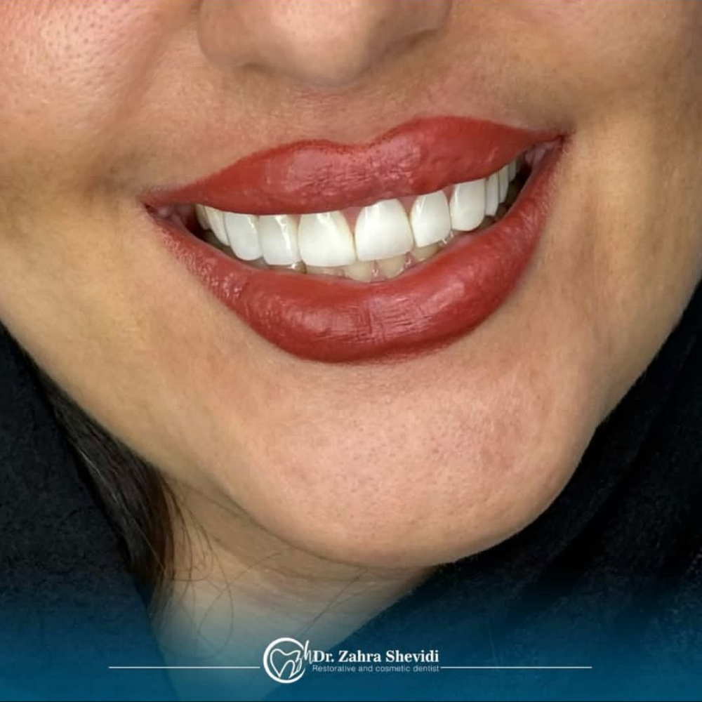 نمونه کار دکتر زهرا شویدی | مطب ۳۶۵