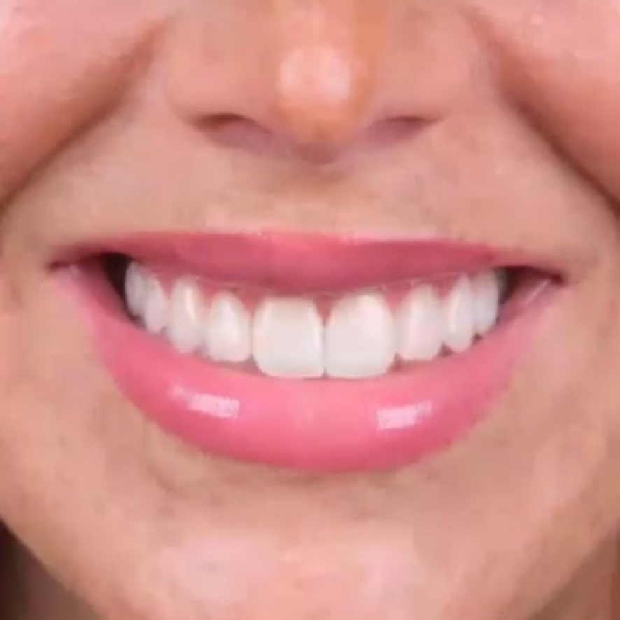 نمونه کار دکتر پریسا گلکار | مطب ۳۶۵