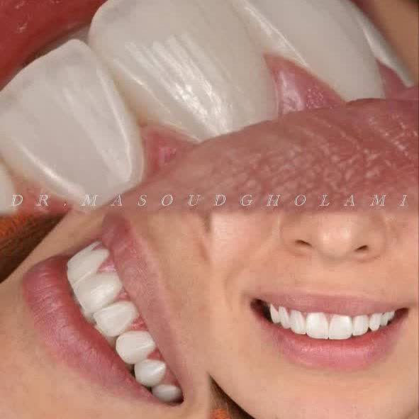 نمونه کار دکتر مسعود غلامی | مطب ۳۶۵