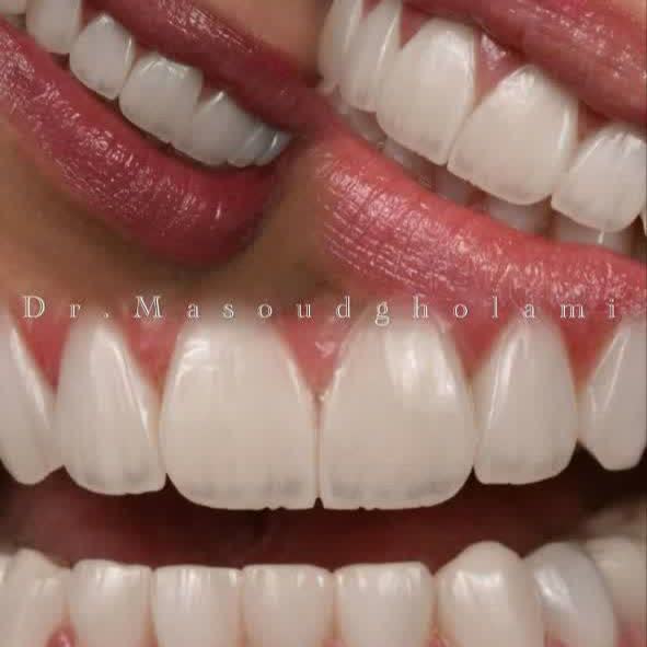 نمونه کار دکتر مسعود غلامی | مطب ۳۶۵