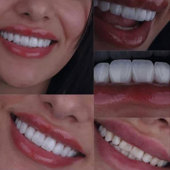 نمونه کار دکتر مسعود غلامی | مطب ۳۶۵