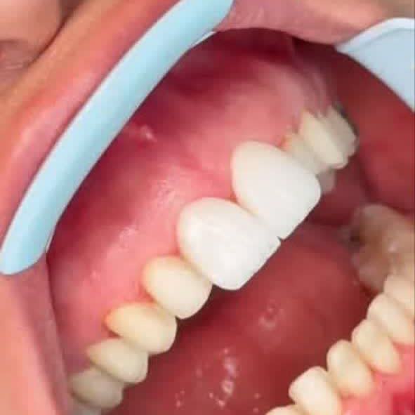 نمونه کار دکتر مسعود غلامی | مطب ۳۶۵