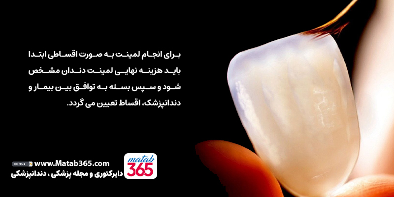 شرایط پرداخت اقساطی لمینت دندان نصف جهان؛ زیبایی بدون فشار مالی | مطب ۳۶۵
