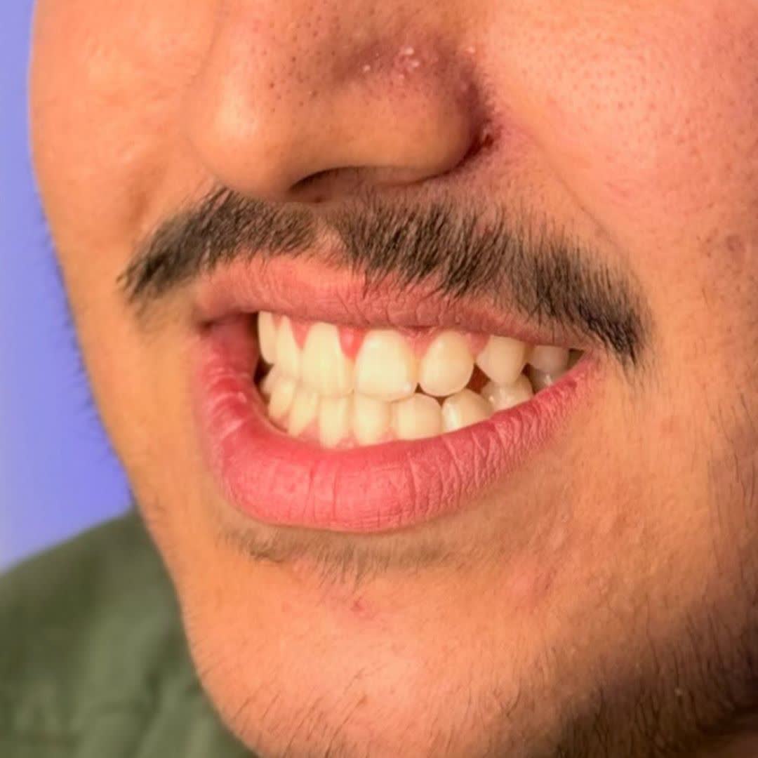 نمونه کار دکتر علیرضا نورانی | مطب ۳۶۵