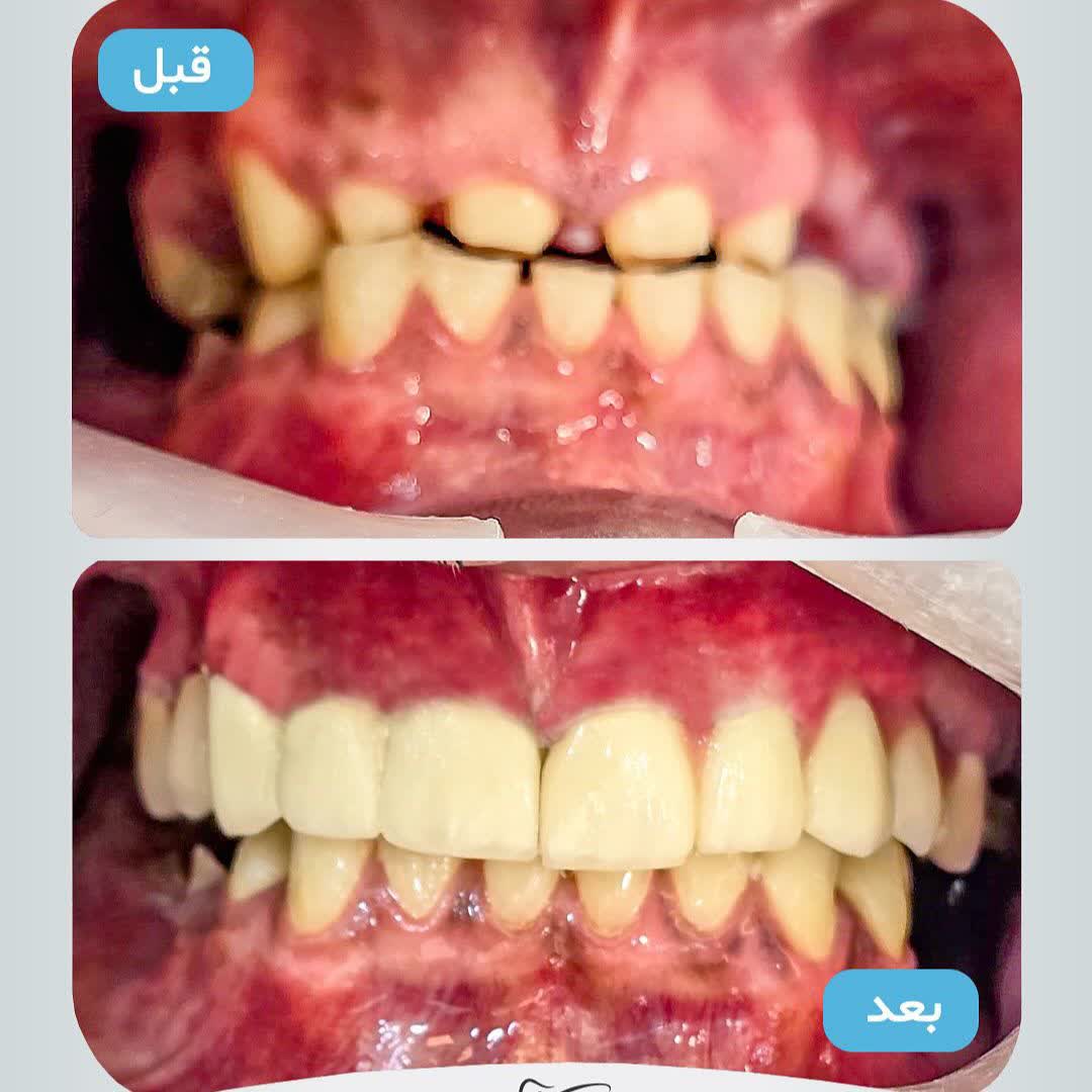 نمونه کار دکتر محمد نورائی | مطب ۳۶۵