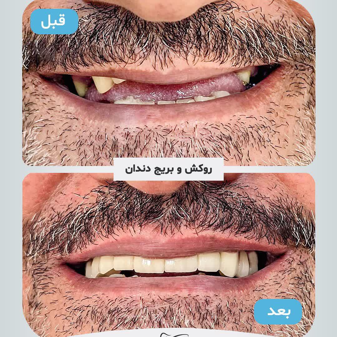 نمونه کار دکتر محمد نورائی | مطب ۳۶۵