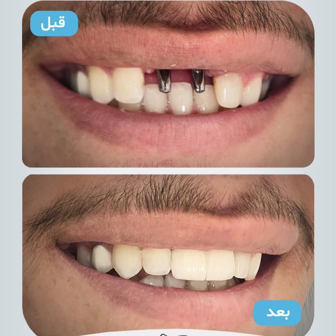 نمونه کار دکتر محمد نورائی | مطب ۳۶۵