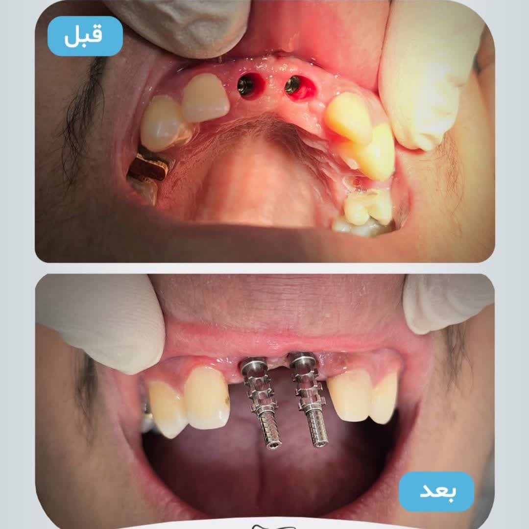 نمونه کار دکتر محمد نورائی | مطب ۳۶۵