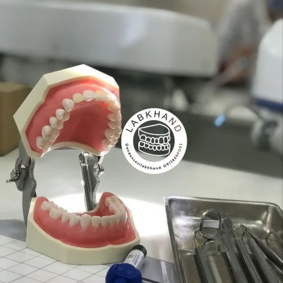 نمونه کار لابراتوار دندانسازی اصفهان لبخند | مطب ۳۶۵