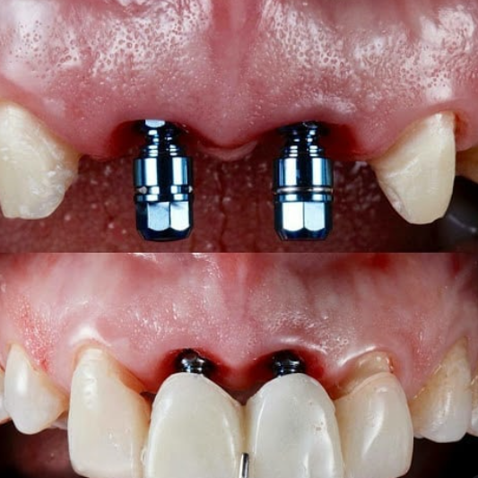 نمونه کار کلینیک دندانپزشکی مهراد اصفهان | مطب ۳۶۵