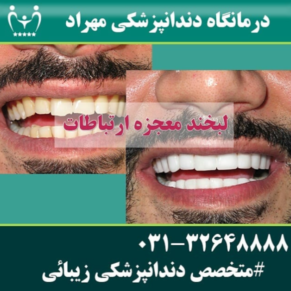 نمونه کار کلینیک دندانپزشکی مهراد اصفهان | مطب ۳۶۵
