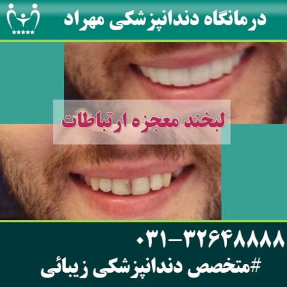 نمونه کار کلینیک دندانپزشکی مهراد اصفهان | مطب ۳۶۵
