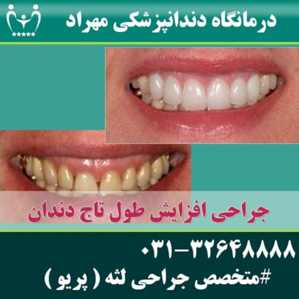 نمونه کار کلینیک دندانپزشکی مهراد اصفهان | مطب ۳۶۵
