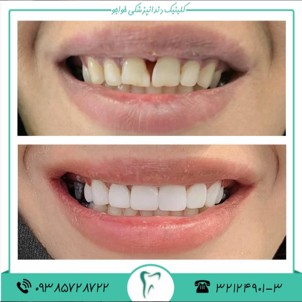 نمونه کار درمانگاه دندانپزشکی خواجو اصفهان | مطب ۳۶۵