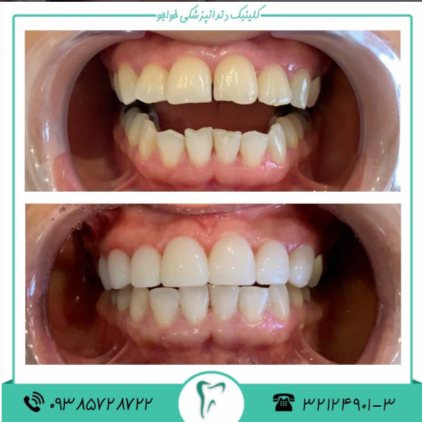 نمونه کار درمانگاه دندانپزشکی خواجو اصفهان | مطب ۳۶۵