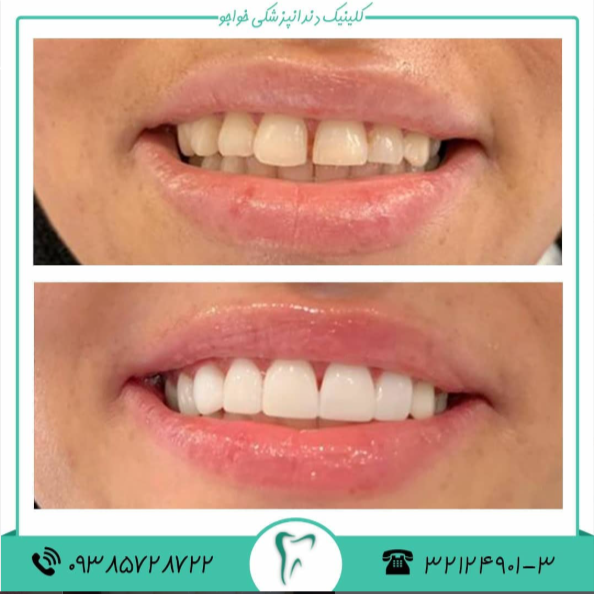 نمونه کار درمانگاه دندانپزشکی خواجو اصفهان | مطب ۳۶۵