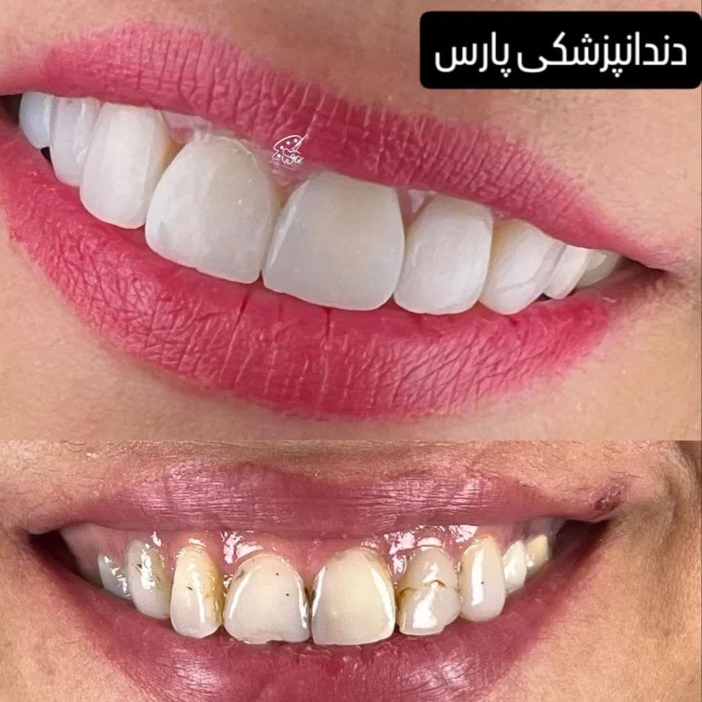 نمونه کار کلینیک دندانپزشکی پارس کاشان | مطب ۳۶۵
