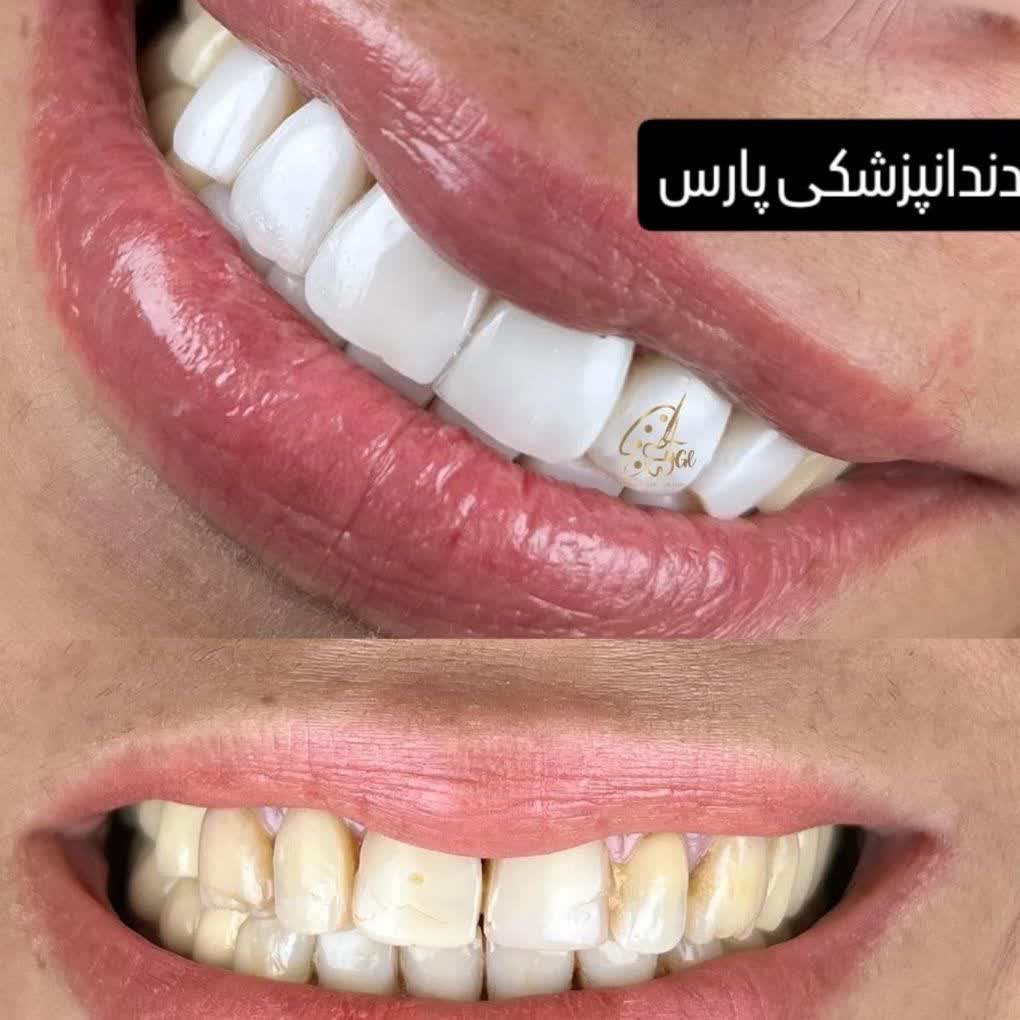 نمونه کار کلینیک دندانپزشکی پارس کاشان | مطب ۳۶۵