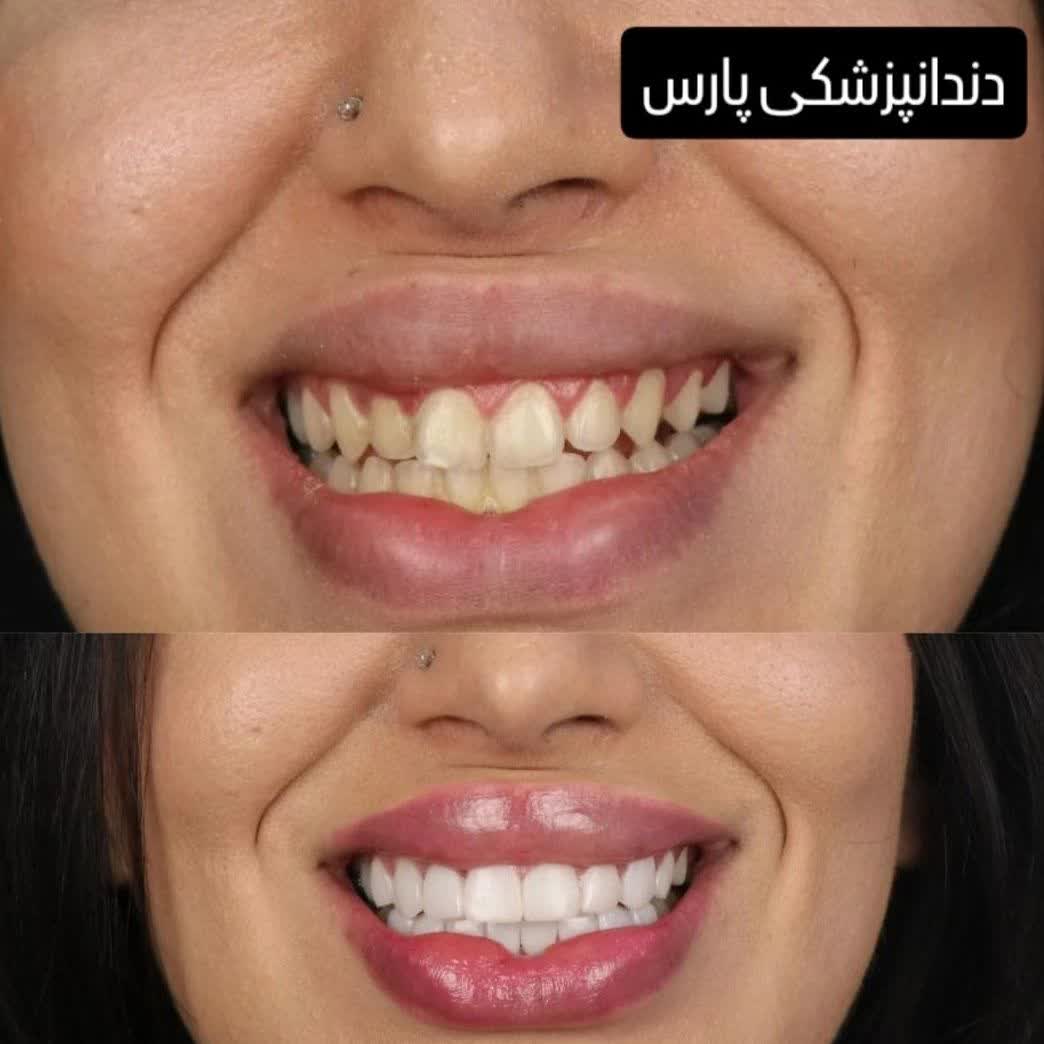 نمونه کار کلینیک دندانپزشکی پارس کاشان | مطب ۳۶۵