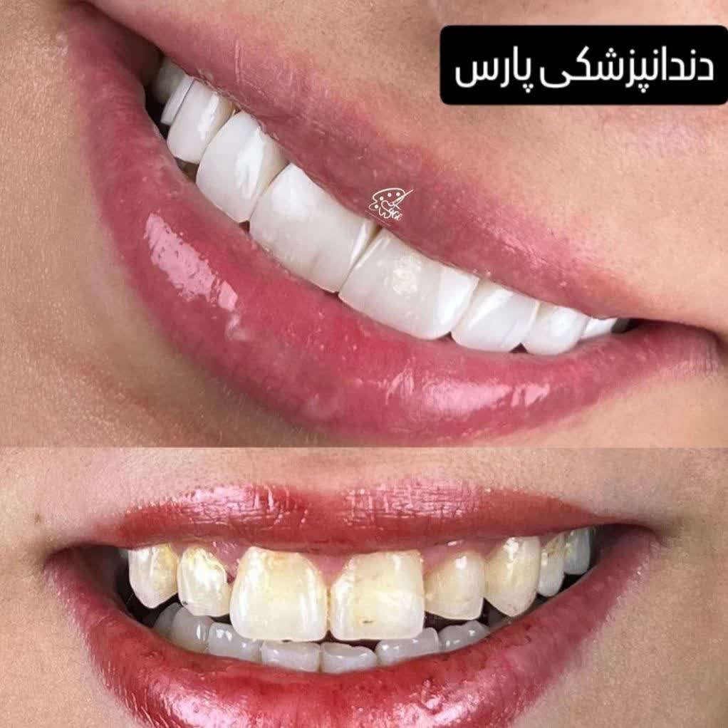 نمونه کار کلینیک دندانپزشکی پارس کاشان | مطب ۳۶۵