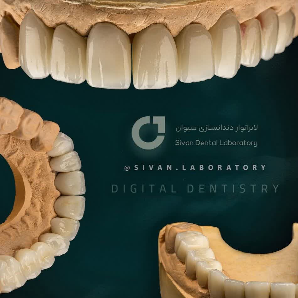 نمونه کار لابراتوار دندانسازی سیوان | مطب ۳۶۵